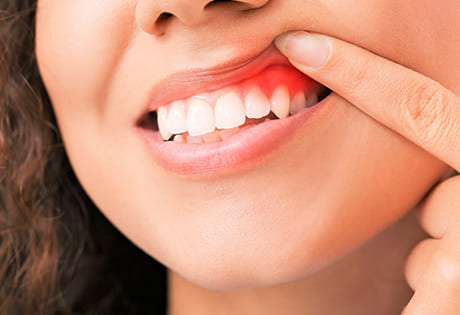 三軒茶屋 UJIIE DENTAL CLINICの歯周病治療